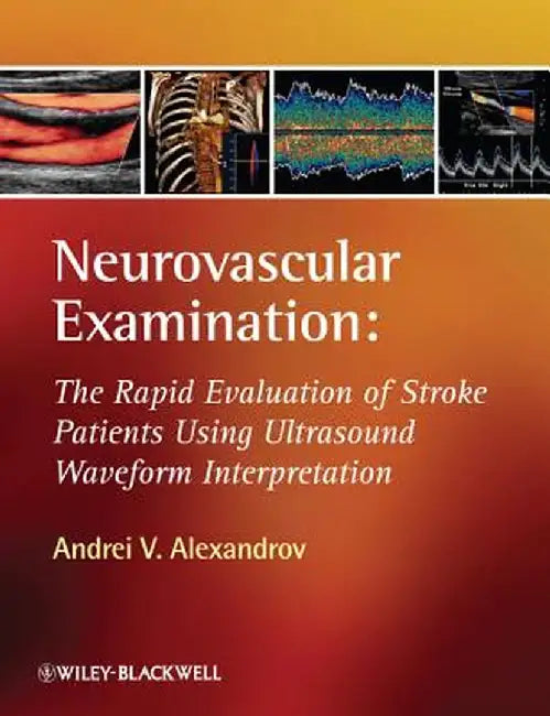 Neurovascular Examination: The Rapid Evaluation of Stroke Patients Using Ultrasound Waveform Interpretation by Andrei V. Alexandrov