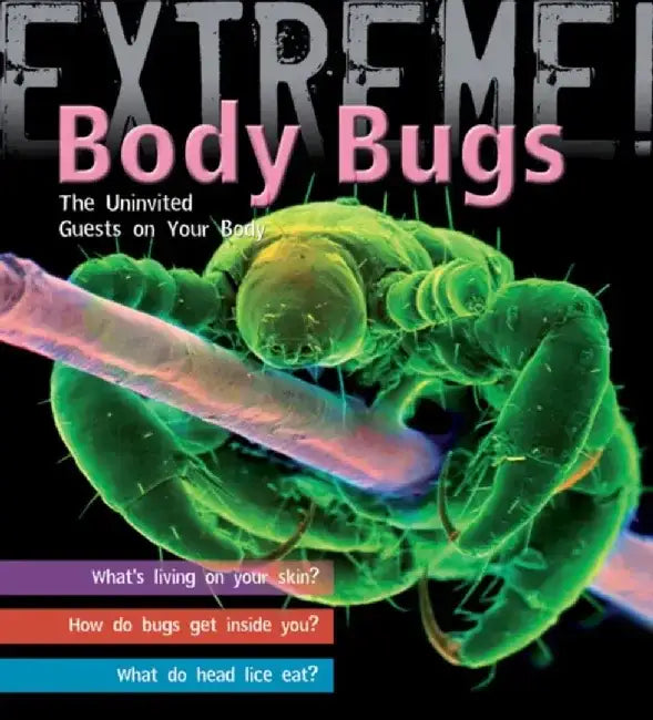 Extreme Science: Body Bugs! by Trevor Day