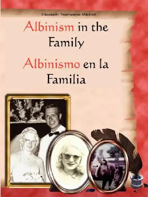 Albinism in the Family: Albinismo en la Familia by Elizabeth Tromsness Mitchell