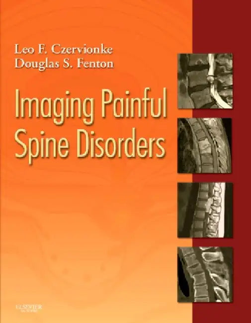 Imaging Painful Spine Disorders [With Access Code] by Leo F. Czervionke