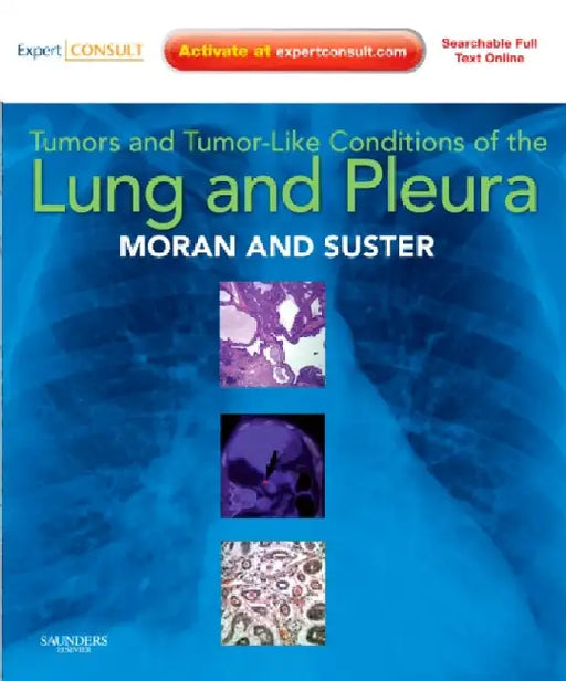 Tumors & Tumor-Like Conditions of the Lung & Pleura by Moran