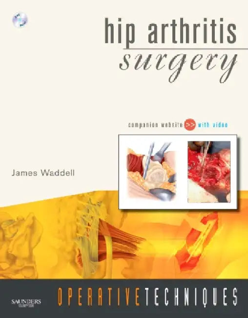 Hip Arthrities Surgery by Waddell