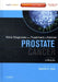 Early Diagnosis & Treatment of Cancer: Prostate Cancer by Su