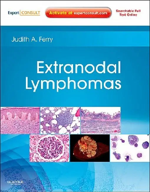 Extranodal Lymphomas: Expert Consult - Online and Print by Judith A. Ferry
