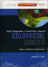 Early Diagnosis and Treatment of Cancer: Colorectal Cancer by Gearhart
