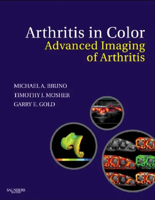 Arthritis in Color: Advanced Imaging of Arthritis by Bruno