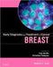 Early Diagnosis and Treatment of Cancer: Breast Cancer by Jacobs