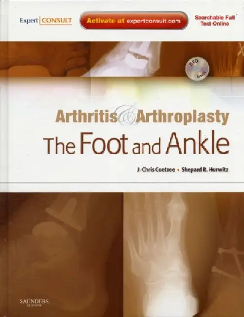 Arthritis & Arthroplasty: The Foot & Ankle, With DVD by Coetzee