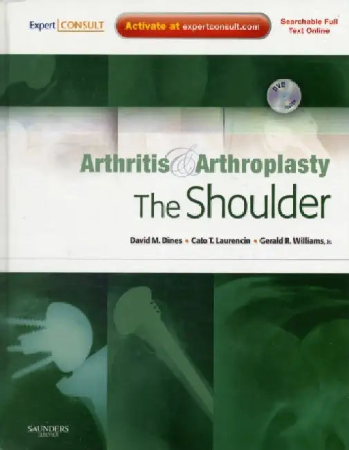 Arthritis & Arthoplasty: The Shoulder With DVD by Dines