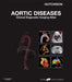 Aortic Diseases by Peter Ashley