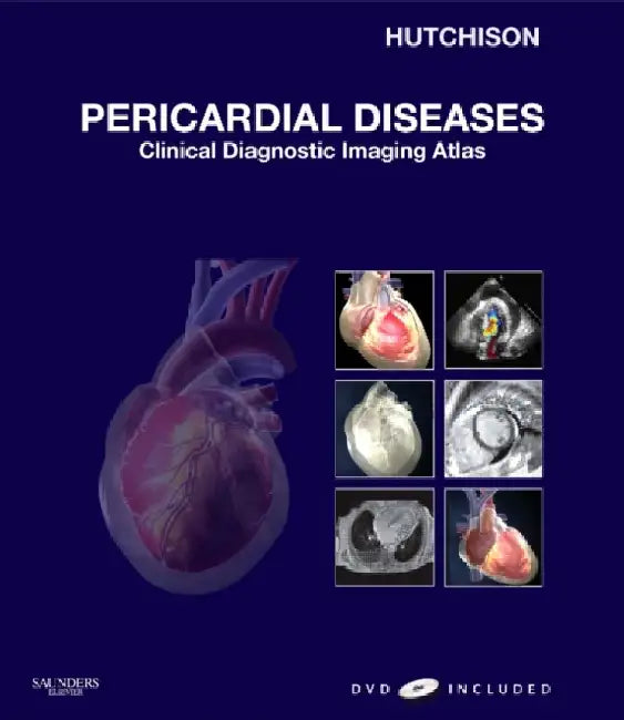 Pericardial Diseases: Clinical Diagnostic Imaging Atlas, With DVD by Hutchison