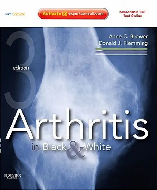 Arthritis in Black & White by Anne C. Brower