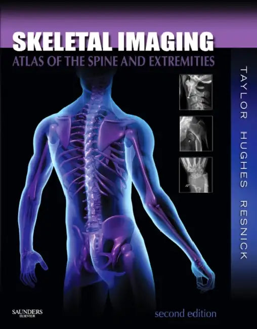Skeletal Imaging: Atlas of the Spine and Extremities by John A. M. Taylor, Tudor H. Hughes, Donald L. Resnick