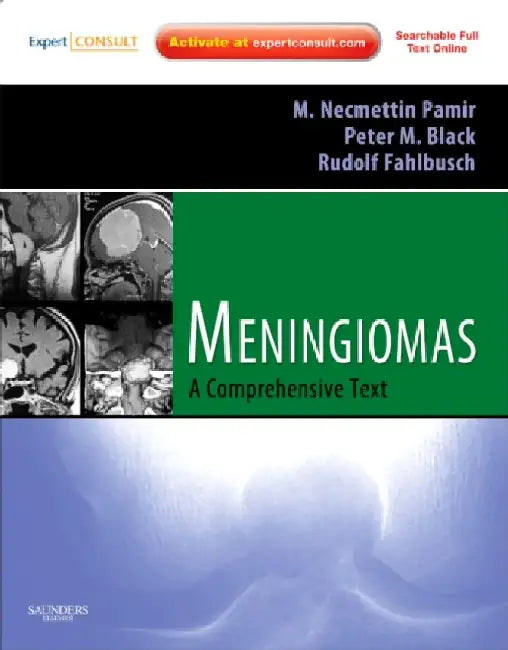 Meningiomas: Expert Consult - Online and Print by Pamir