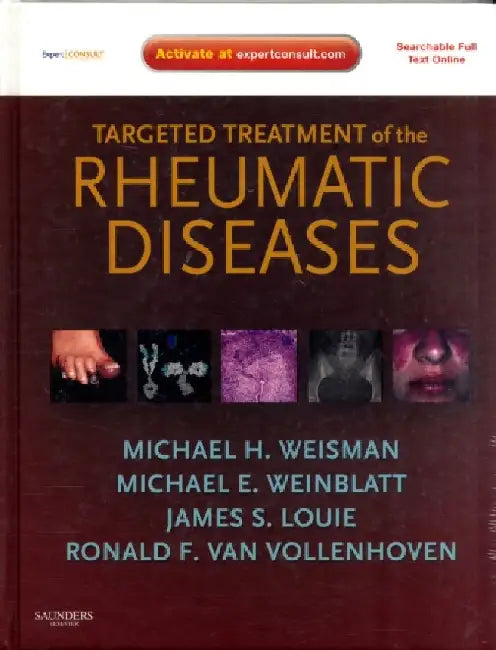 Targeted Treatment of the Rheumatic Diseases by Zhenyu Fu