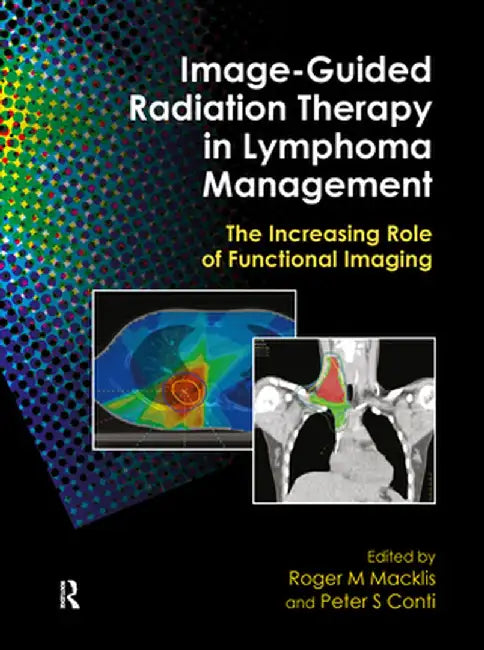 Image-Guided Radiation Therapy in Lymphoma Management: The Increasing Role of Functional Imaging by Roger M. Macklis