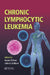 Chronic Lymphocytic Leukemia by Susan O'Brien