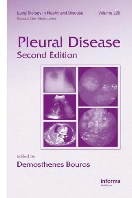Pleural Disease by Demosthenes Bouros