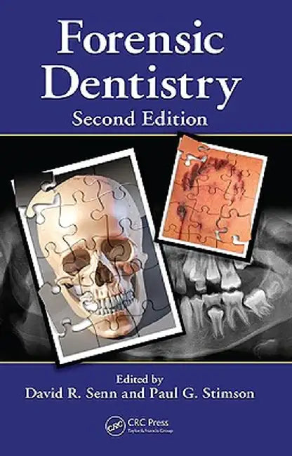 Forensic Dentistry by David R. Senn