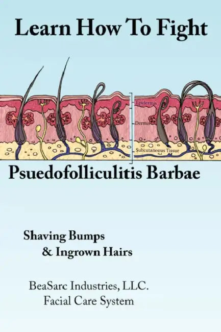 Learn How To Fight Psuedofolliculitis Barbae: Shaving Bumps & Ingrown Hairs by Beasarc Industries LLC