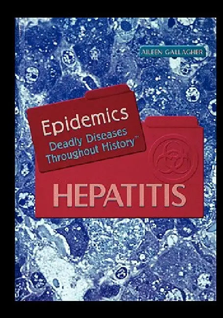 Hepatitis by Aileen Gallagher