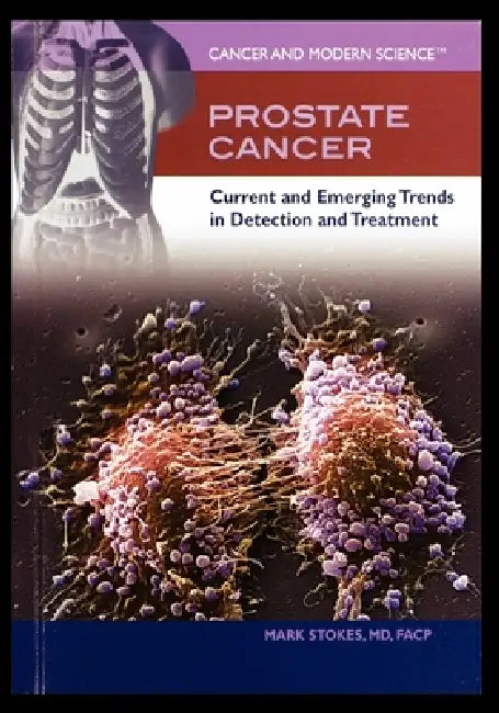Prostate Cancer: Current and Emerging Trends in Detection and Treatment by Mark Stokes