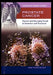 Prostate Cancer: Current and Emerging Trends in Detection and Treatment by Mark Stokes