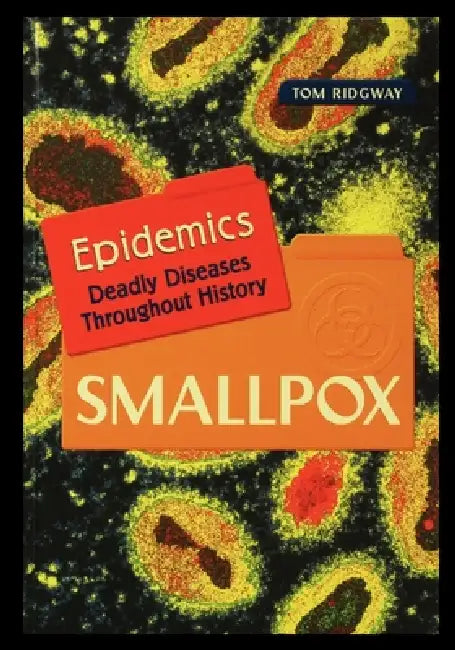 Smallpox by Tom Ridgway