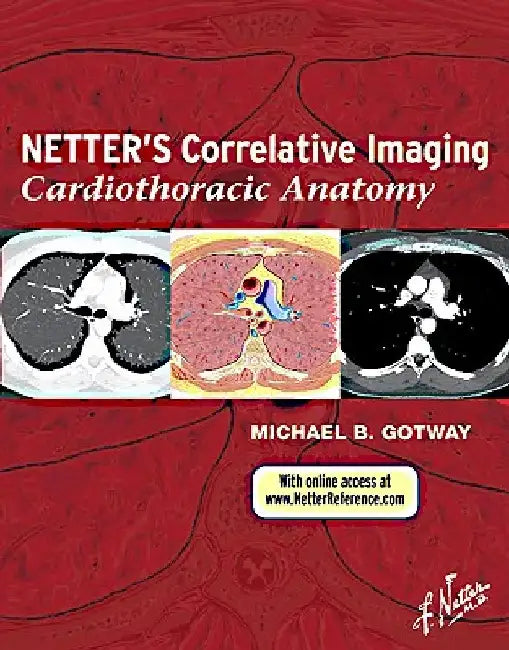 Netter's Correlative Imaging: Cardiothoracic Anatomy with Access Code by Michael Gotway