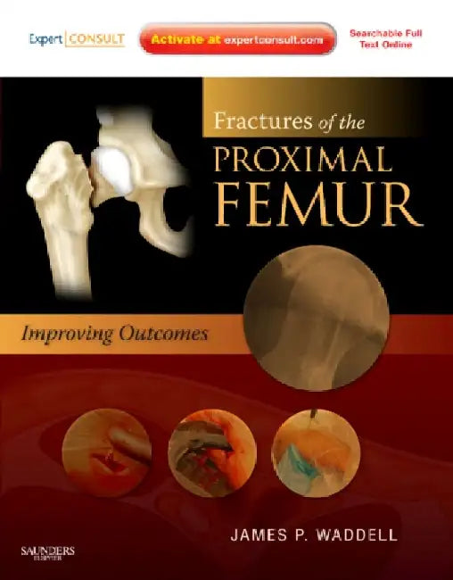 Fractures of the Proximal Femur: Improving Outcomes by Waddell