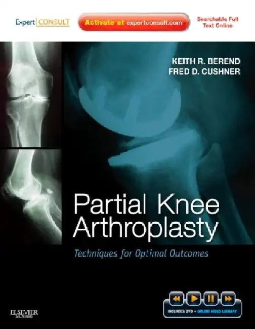 Partial Knee Arthroplasty: Techniques for Optimal Outcomes by Berend