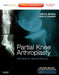 Partial Knee Arthroplasty: Techniques for Optimal Outcomes by Berend