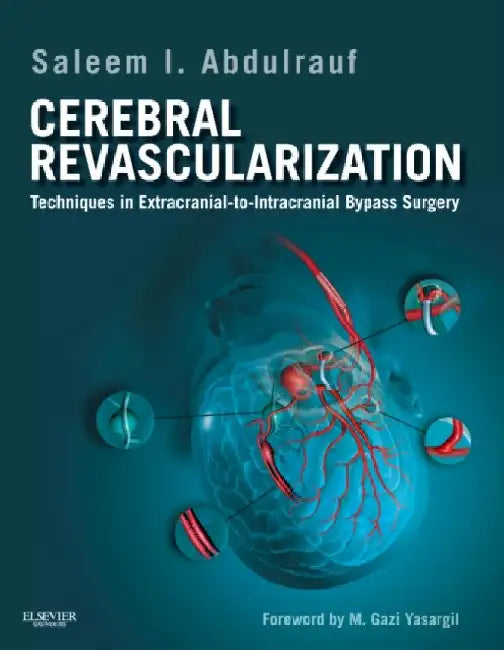 Cerebral Revascularization by William Archer