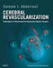 Cerebral Revascularization by William Archer