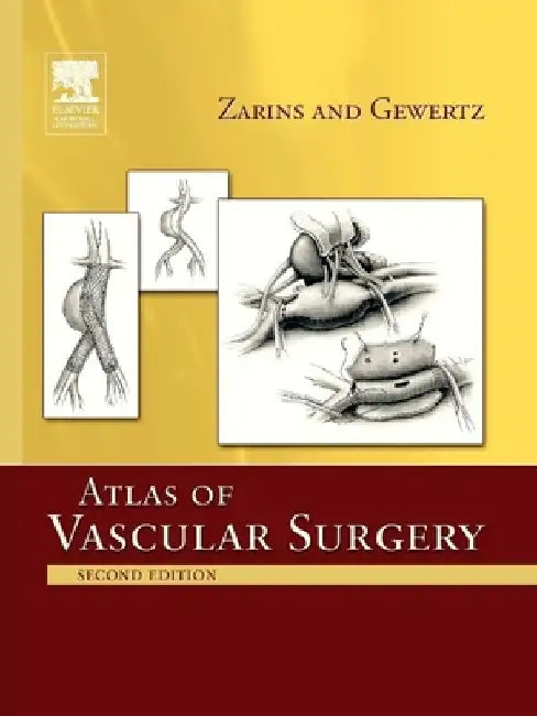 Atlas of Vascular Surgery - Paperback Edition by Christopher K. Zarins