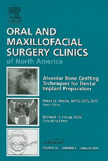 Alveolar Bone Grafting Techniques for Dental Implant Preparation, an Issue of Oral and Maxillofacial Surgery Clinics: Volume 22-3 by Peter Waite