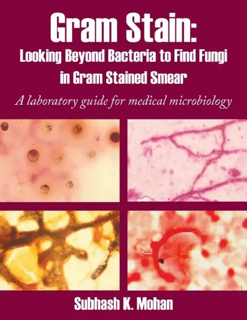 Gram Stain: Looking Beyond Bacteria to Find Fungi in Gram Stained Smear: A Laboratory Guide for Medical Microbiology by Subhash K. Mohan