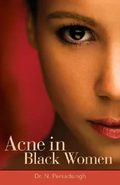 Acne in Black Women by N. Persadsingh