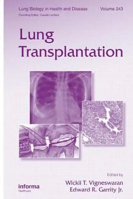 Lung Transplantation by Wickii Vigneswaran