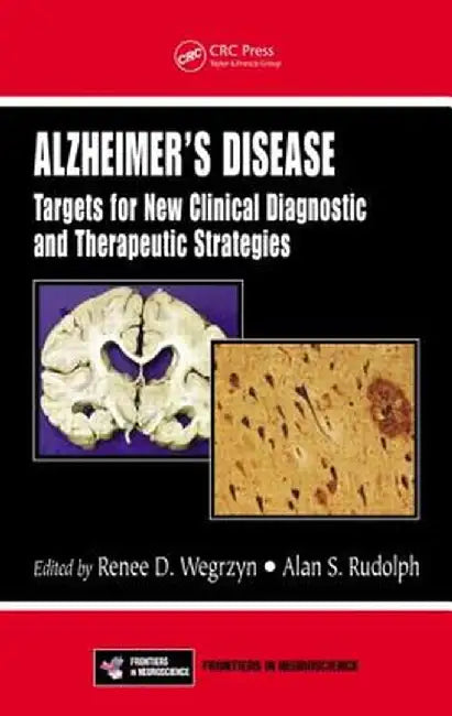 Alzheimer's Disease: Targets for New Clinical Diagnostic and Therapeutic Strategies by Renee D. Wegrzyn