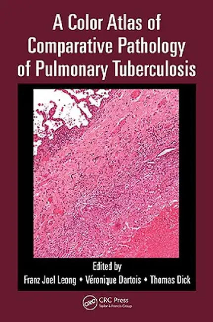 A Color Atlas of Comparative Pathology of Pulmonary Tuberculosis by Franz Joel Leong