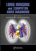 Lung Imaging and Computer Aided Diagnosis by Ayman El-Baz