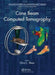 Cone Beam Computed Tomography by Chris C. Shaw