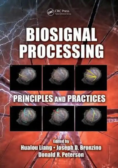 Biosignal Processing: Principles and Practices by Hualou Liang