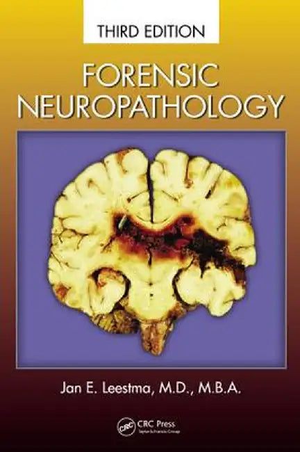 Forensic Neuropathology by Jan E. Leestma