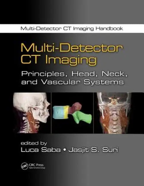 Multi-Detector CT Imaging: Principles, Head, Neck, and Vascular Systems by Luca Saba