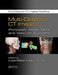 Multi-Detector CT Imaging: Principles, Head, Neck, and Vascular Systems by Luca Saba