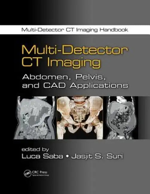 Multi-Detector CT Imaging: Abdomen, Pelvis, and CAD Applications by Luca Saba