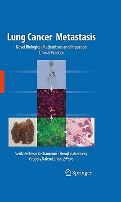 Lung Cancer Metastasis: Novel Biological Mechanisms and Impact on Clinical Practice by Venkateshwar Keshamouni