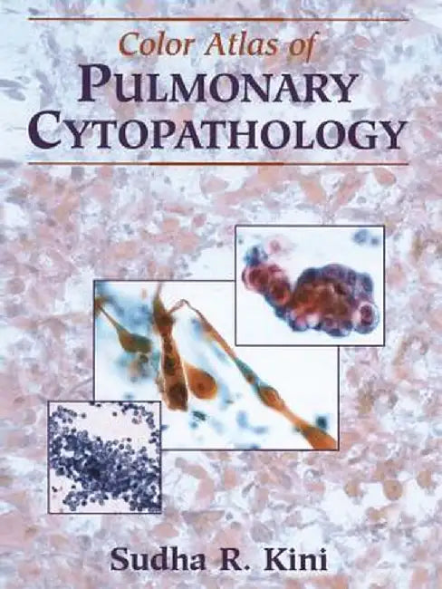 Color Atlas of Pulmonary Cytopathology by Sudha R. Kini